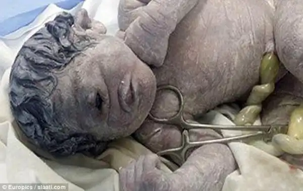 End Time? Baby Boy Born With 